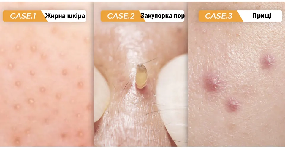 Для якої шкіри призначена серія NUMBUZIN No.1