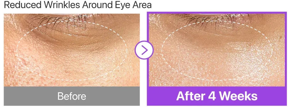 Ліфтинг-есенція з коензимом NAD - NUMBUZIN NAD No.9 NAD Bio Lifting Essence, 30 мл - фото N6