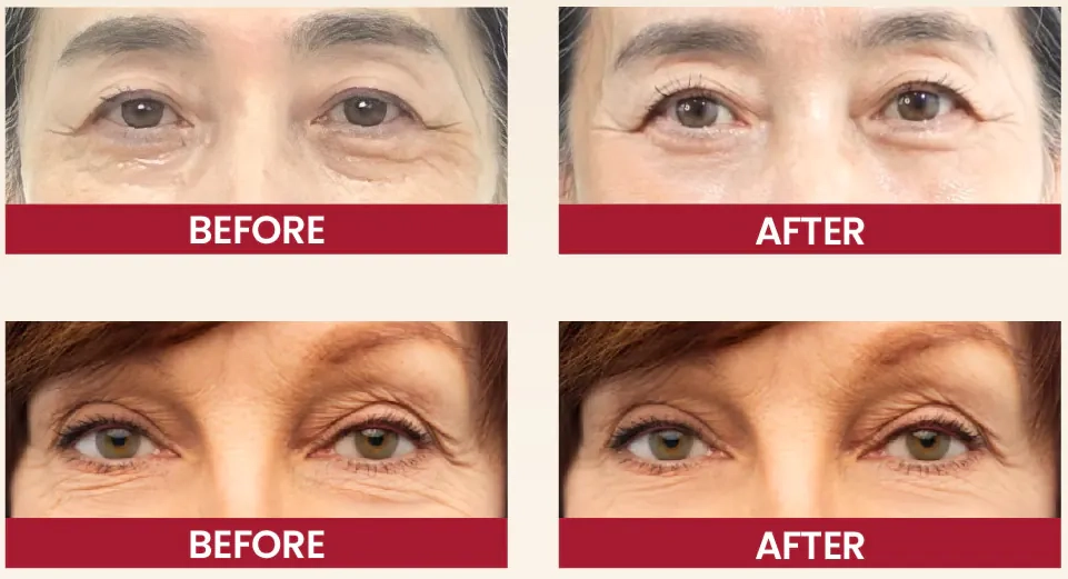 Результати використання крему під очі K-Secret Seoul 1988 Eye Cream Retinal Liposome 4% + Fermented Bean