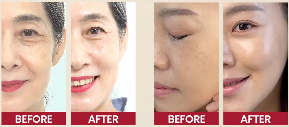 Результати використання сироватки K-Secret Seoul 1988 Serum Retinal Liposome 2% + Black Ginseng