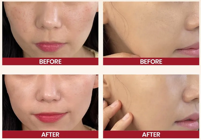 Результати використання крему K-Secret Seoul 1988 Cream Snail Mucin 93% + Rice