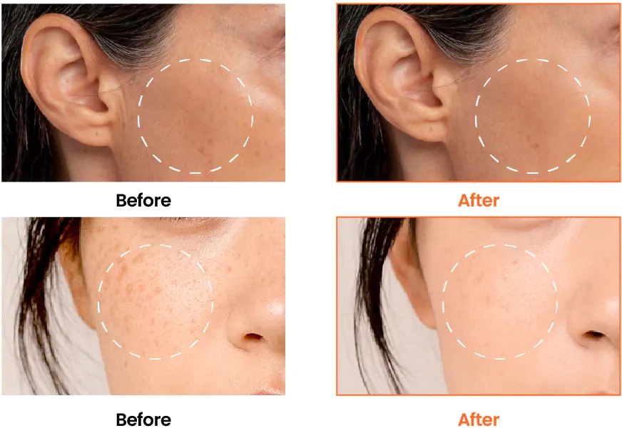 Результати після сироватки K-Secret Seoul 1988 Glow Serum Niacinamide 15% + Yuja