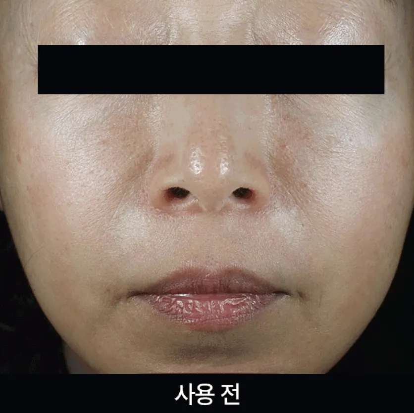 Осветляющая сыворотка против пигментных пятен с экзосомами - APOTHE Exosome Mela-Glu Dark Spot Ampoule, 30 мл, ПРИМЯТА УПАКОВКА - фото N6