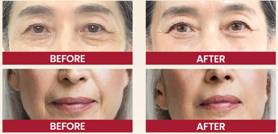 Результати використання крему K-Secret Seoul 1988 Cream: Retinal Liposome 1% + Fermented Rice