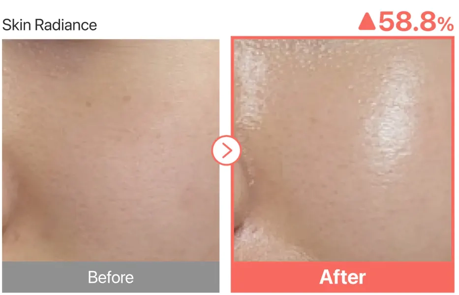 Ефект &laquo;Glass skin&raquo; після тонера NUMBUZIN No.3 Super Glowing Essence Toner