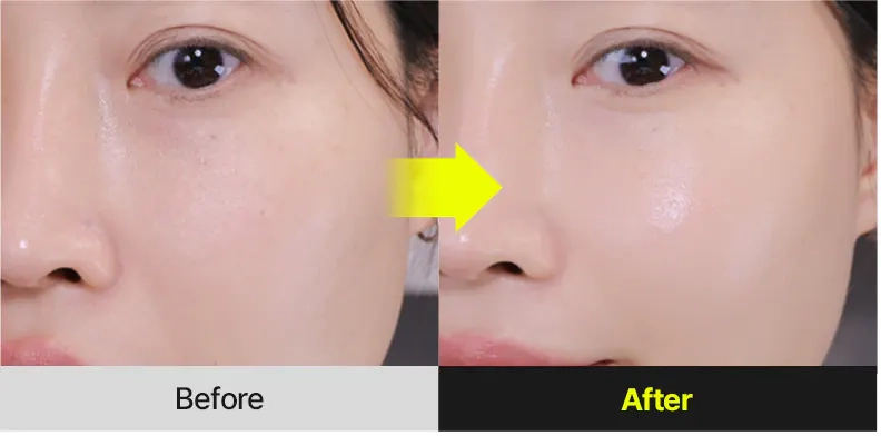 Результати використання Medi peel Retinal NMN Bounce Shot Eye Cream