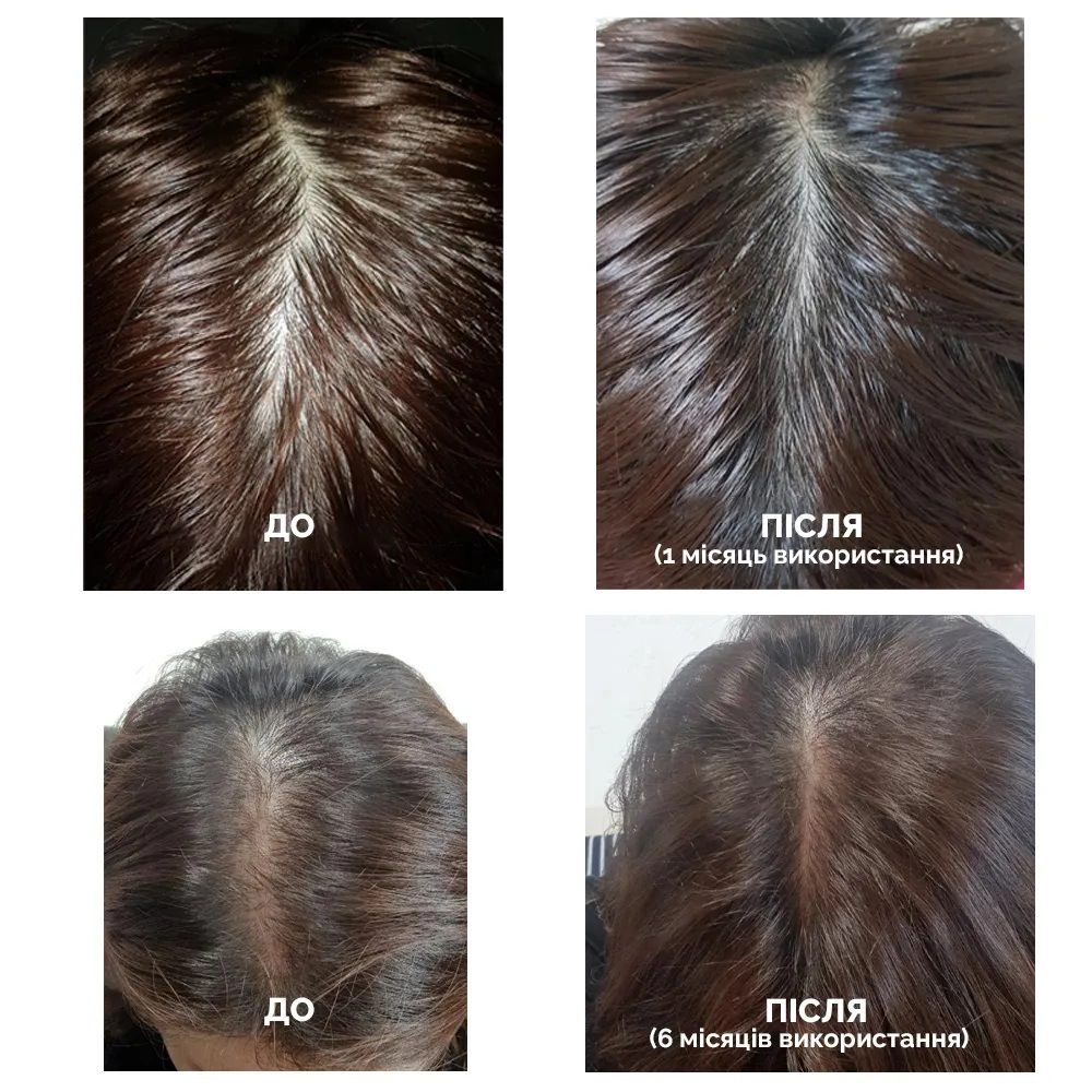 Стимулюючий тонік для росту волосся - Dr. ForHair Folligen Tonic, 120 мл - фото N2