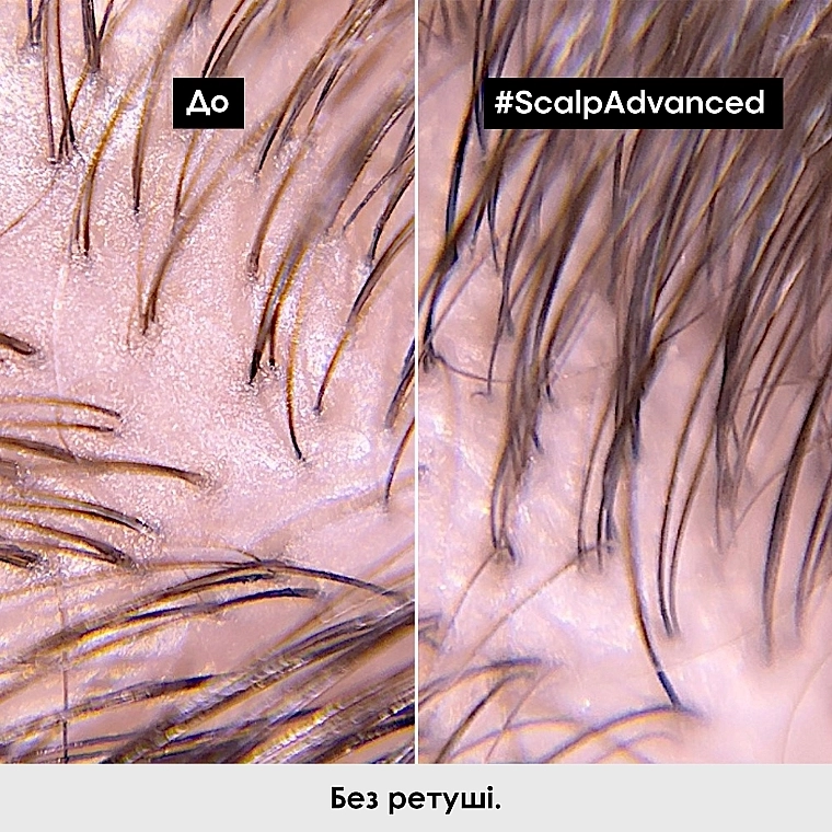 L'Oreal Professionnel Профессиональный очищающий шампунь для склонных к жирности волос Scalp Advanced Anti-Oiliness Shampoo - фото N6