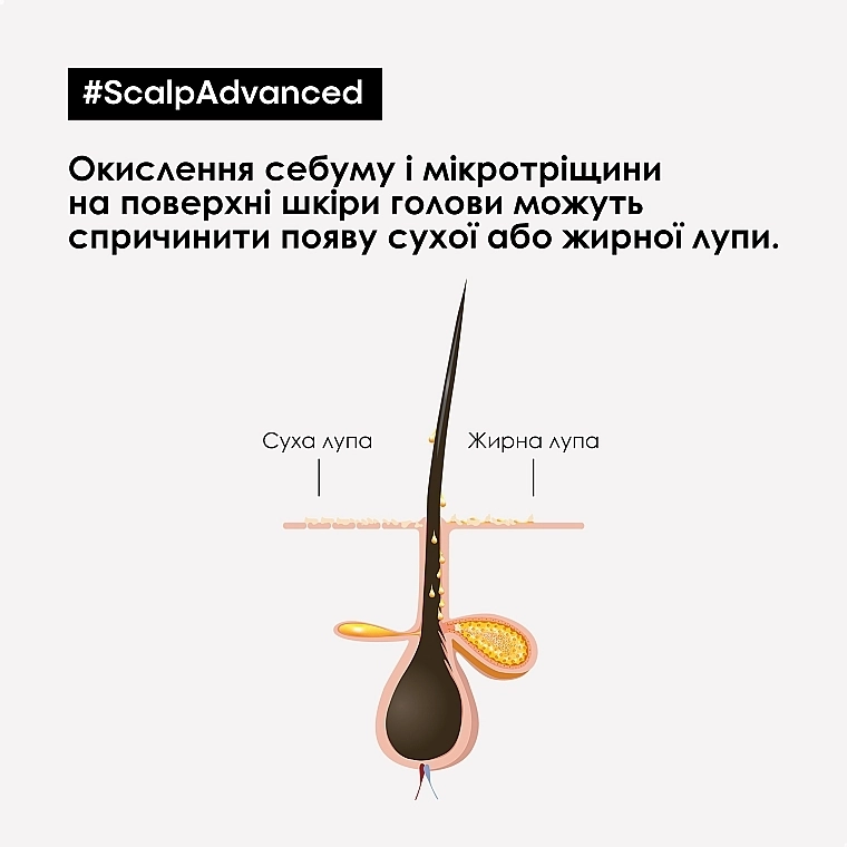 L'Oreal Professionnel Професійний дерморегулюючий шампунь проти лупи Scalp Advanced Anti Dandruff Shampoo - фото N5