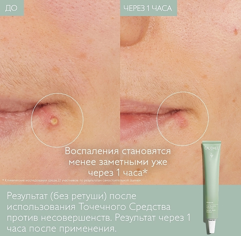 Caudalie Средство косметическое с салициловой кислотой Vinopure Salicylic Spot Solution - фото N3