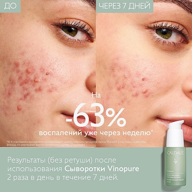 Caudalie Сироватка для обличчя "Контроль недоліків" Vinopure Blemish Control Infusion Serum - фото N7