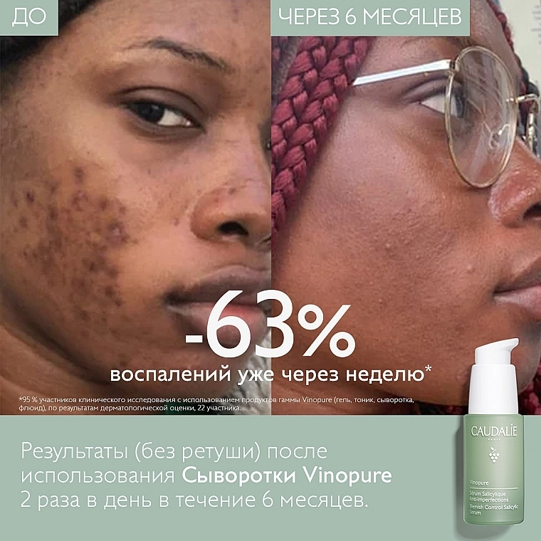 Caudalie Сироватка для обличчя "Контроль недоліків" Vinopure Blemish Control Infusion Serum - фото N10