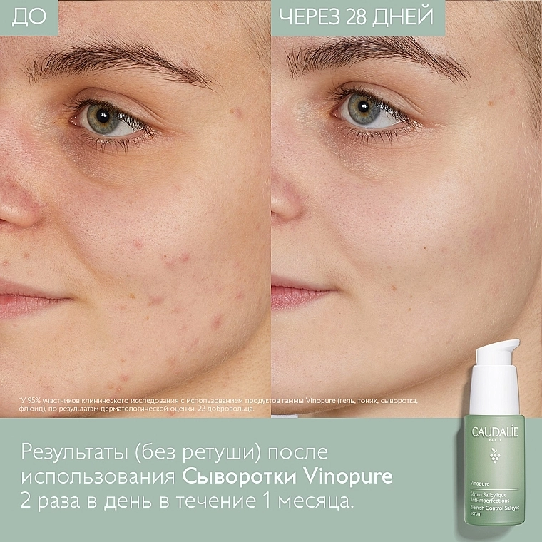 Caudalie Сироватка для обличчя "Контроль недоліків" Vinopure Blemish Control Infusion Serum - фото N13