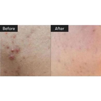 Сыворотка с микроиглами для улучшения текстуры и тона кожи - VT Cosmetics Reedle Shot 100, 50 мл