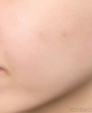 Заживляющие патчи от прыщей - SKIN1004 Madagascar Centella Tea-Trica Spot Cover Patch, 22 шт