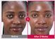 Концентрированная сыворотка для упругости кожи - NUMBUZIN No.2 Rose PDRN Collagen 2X Plumping Serum, 30 мл
