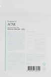 Набор - Pyunkang Yul Acne Set, (cl/foam/120ml + mask/18g + patch/15pc) - фото N5