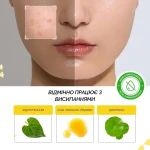 Точкові заспокійливі патчі від прищів з хауттюйнією - ABIB Heartleaf Calming Spot Patch, 78 шт - фото N4