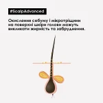 L'Oreal Professionnel Професійний очищуючий шампунь для схильного до жирності волосся Scalp Advanced Anti-Oiliness Shampoo - фото N5